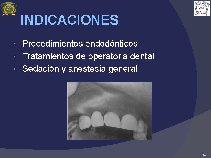 INDICACIONES Procedimientos endodónticos Tratamientos de operatoria dental Sedación y anestesia general 22 