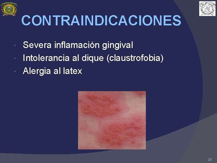 CONTRAINDICACIONES Severa inflamación gingival Intolerancia al dique (claustrofobia) Alergia al latex 23 