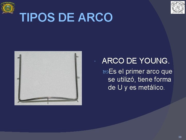 TIPOS DE ARCO DE YOUNG. Es el primer arco que se utilizó, tiene forma