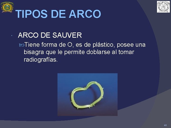 TIPOS DE ARCO DE SAUVER Tiene forma de O, es de plástico, posee una