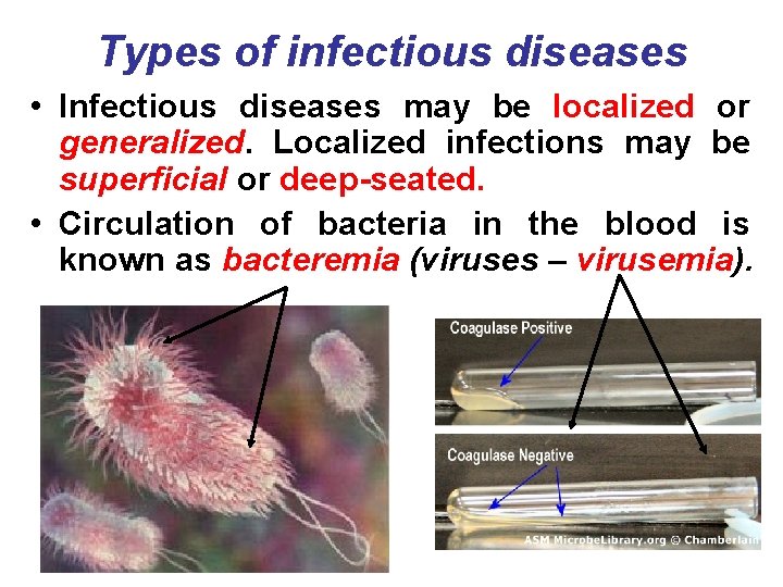 Types of infectious diseases • Infectious diseases may be localized or generalized. Localized infections