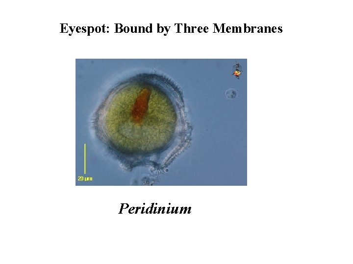 Eyespot: Bound by Three Membranes Peridinium 