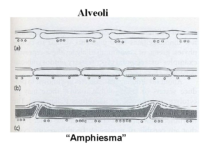 Alveoli “Amphiesma” 