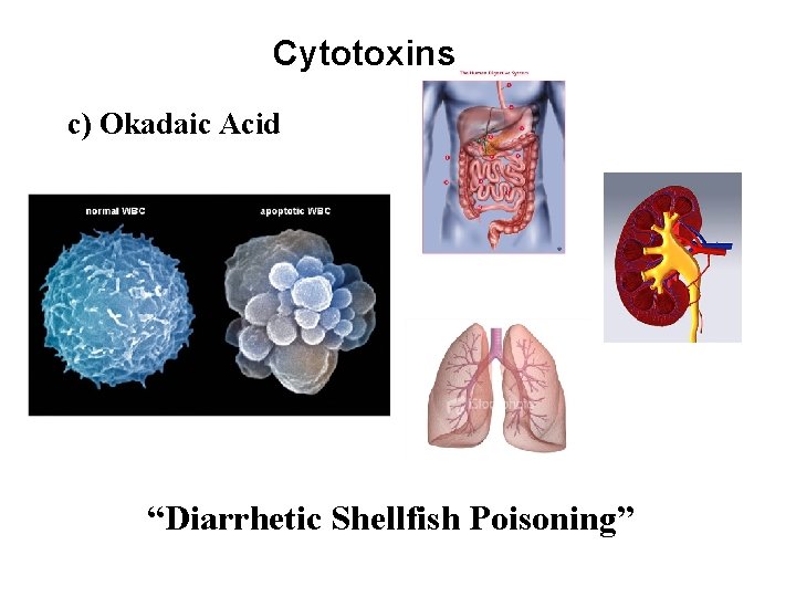 Cytotoxins c) Okadaic Acid “Diarrhetic Shellfish Poisoning” 