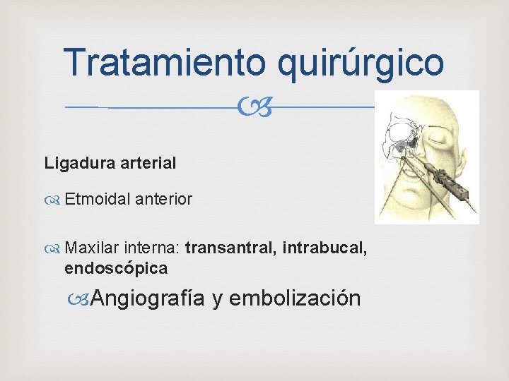 Tratamiento quirúrgico Ligadura arterial Etmoidal anterior Maxilar interna: transantral, intrabucal, endoscópica Angiografía y embolización