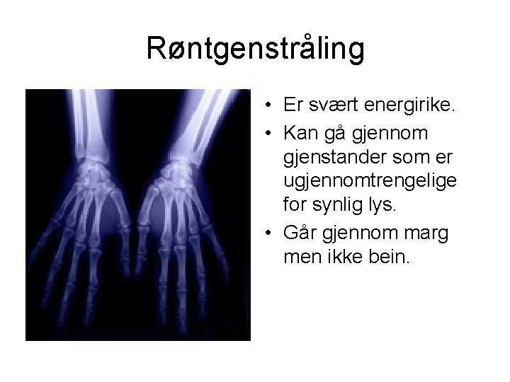 Røntgenstråling • Er svært energirike. • Kan gå gjennom gjenstander som er ugjennomtrengelige for