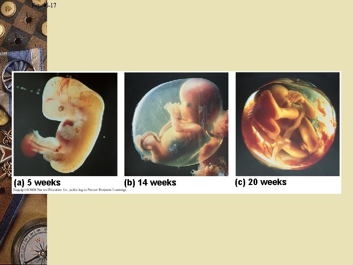 Fig. 46 -17 (a) 5 weeks (b) 14 weeks (c) 20 weeks 