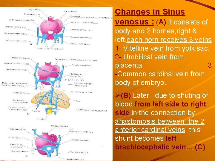 Changes in Sinus venosus : (A) It consists of body and 2 hornes, right Changes in Sinus venosus : (A) It consists of body and 2 hornes, right