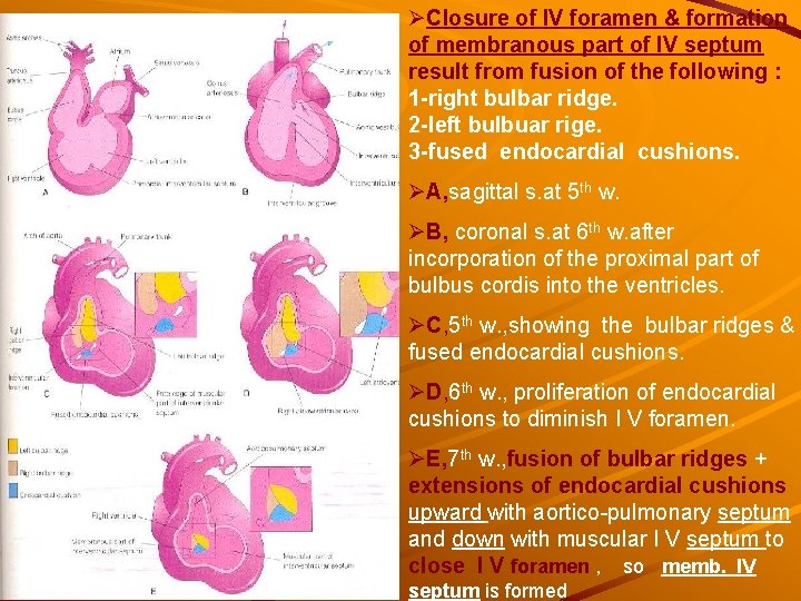 ØClosure of IV foramen & formation of membranous part of IV septum result from ØClosure of IV foramen & formation of membranous part of IV septum result from