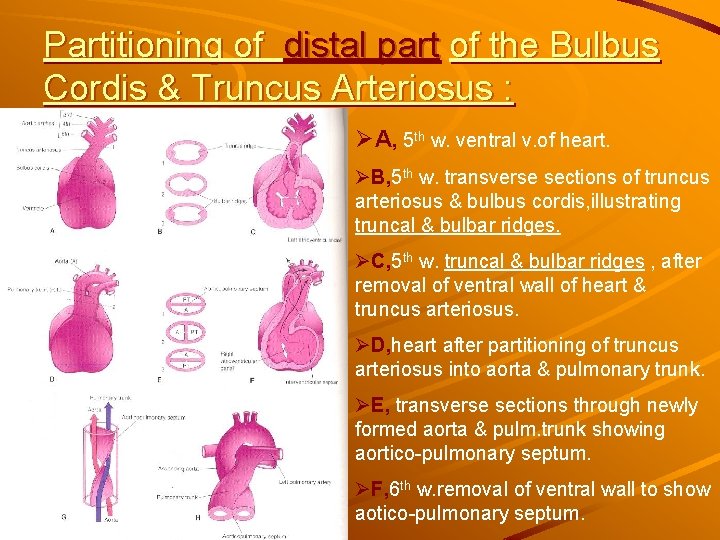 Partitioning of distal part of the Bulbus Cordis & Truncus Arteriosus : ØA, 5 Partitioning of distal part of the Bulbus Cordis & Truncus Arteriosus : ØA, 5