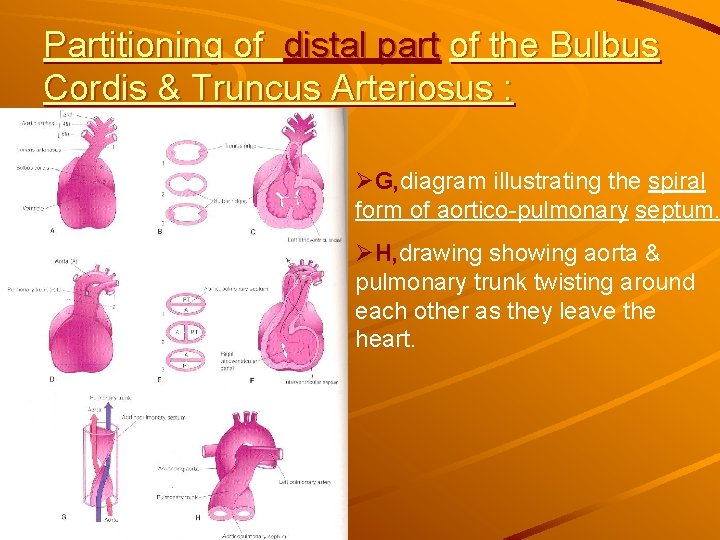 Partitioning of distal part of the Bulbus Cordis & Truncus Arteriosus : ØG, diagram Partitioning of distal part of the Bulbus Cordis & Truncus Arteriosus : ØG, diagram