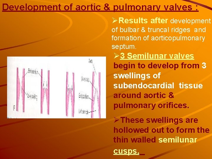 Development of aortic & pulmonary valves : ØResults after development of bulbar & truncal Development of aortic & pulmonary valves : ØResults after development of bulbar & truncal