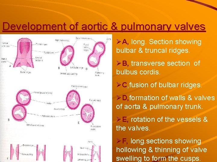 Development of aortic & pulmonary valves ØA, long. Section showing bulbar & truncal ridges. Development of aortic & pulmonary valves ØA, long. Section showing bulbar & truncal ridges.