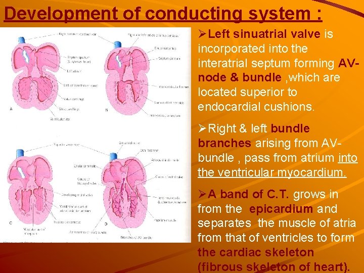 Development of conducting system : ØLeft sinuatrial valve is incorporated into the interatrial septum Development of conducting system : ØLeft sinuatrial valve is incorporated into the interatrial septum