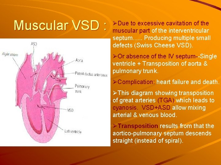 Muscular VSD : ØDue to excessive cavitation of the muscular part of the interventricular Muscular VSD : ØDue to excessive cavitation of the muscular part of the interventricular