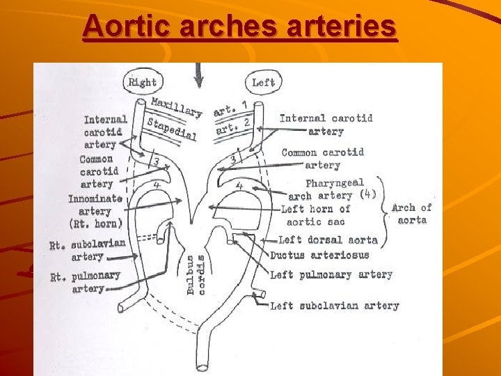 Aortic arches arteries Aortic arches arteries