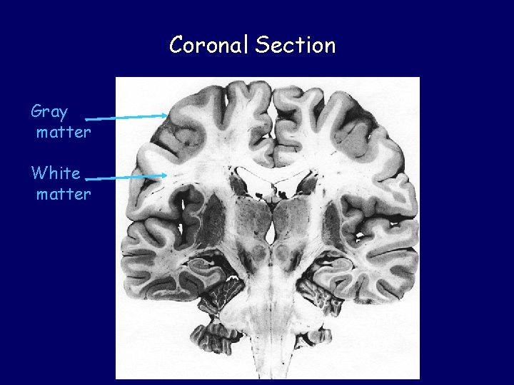 Coronal Section Gray matter White matter 