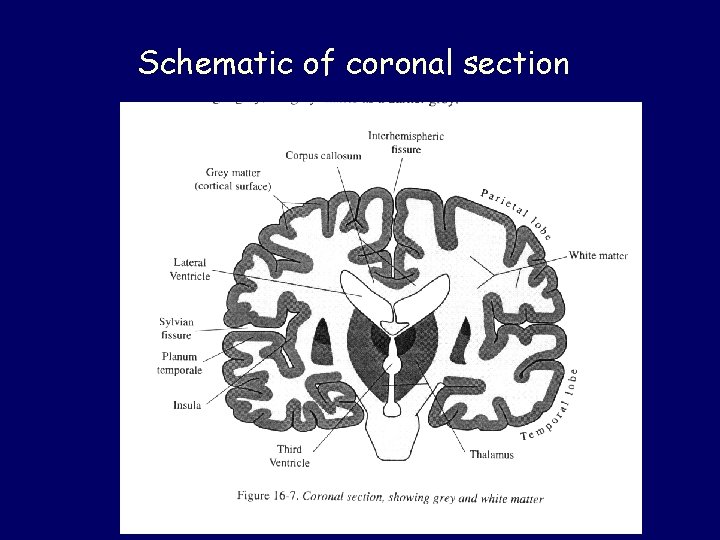 Schematic of coronal section 