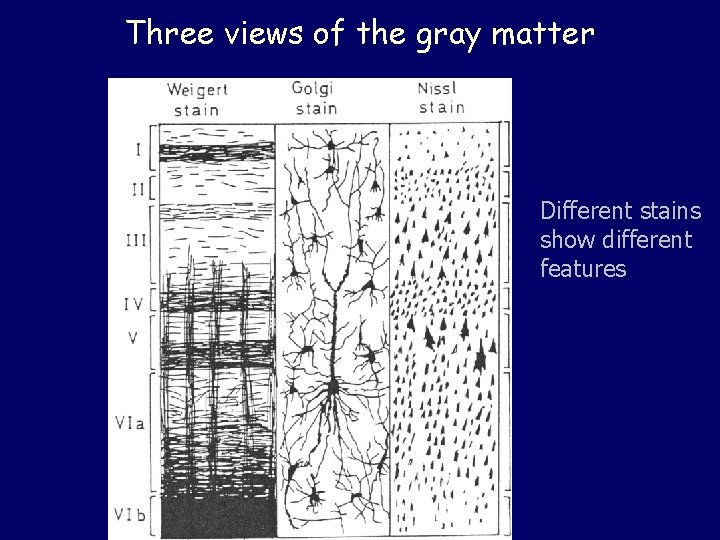 Three views of the gray matter Different stains show different features 