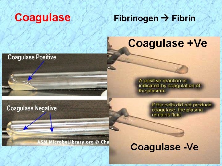 Coagulase Fibrinogen Fibrin Coagulase +Ve Coagulase -Ve 