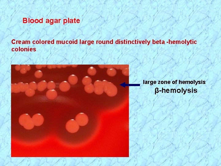 Blood agar plate Cream colored mucoid large round distinctively beta -hemolytic colonies large zone