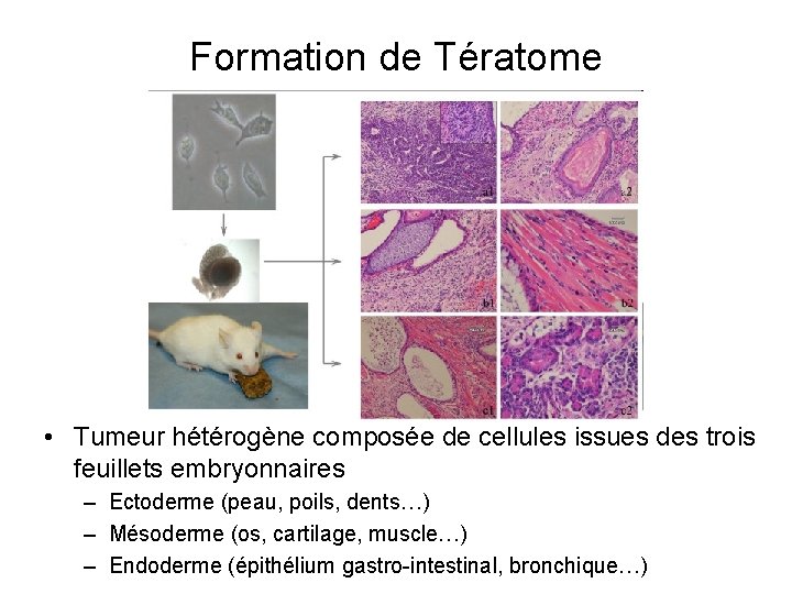 Formation de Tératome • Tumeur hétérogène composée de cellules issues des trois feuillets embryonnaires