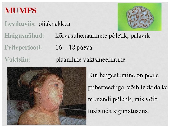 MUMPS Levikuviis: piisknakkus Haigusnähud: kõrvasüljenäärmete põletik, palavik Peiteperiood: 16 – 18 päeva Vaktsiin: plaaniline