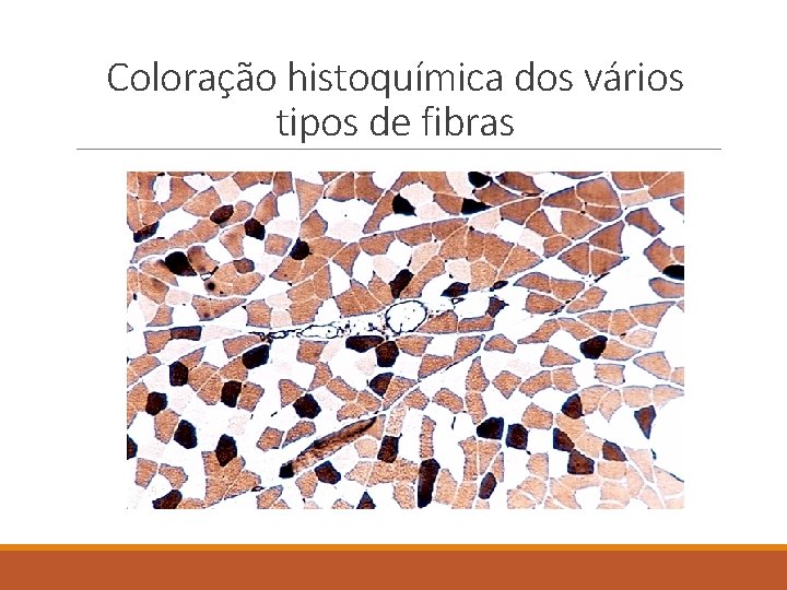 Coloração histoquímica dos vários tipos de fibras Coloração histoquímica dos vários tipos de fibras