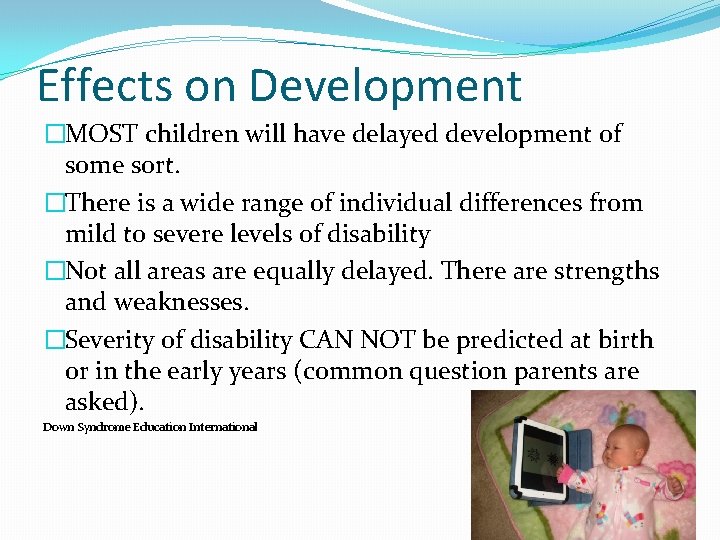 Effects on Development �MOST children will have delayed development of some sort. �There is