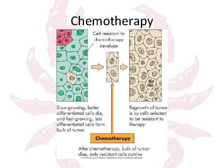 Chemotherapy 