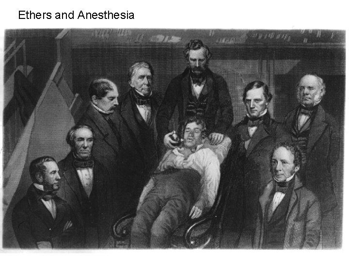 Ethers and Anesthesia 