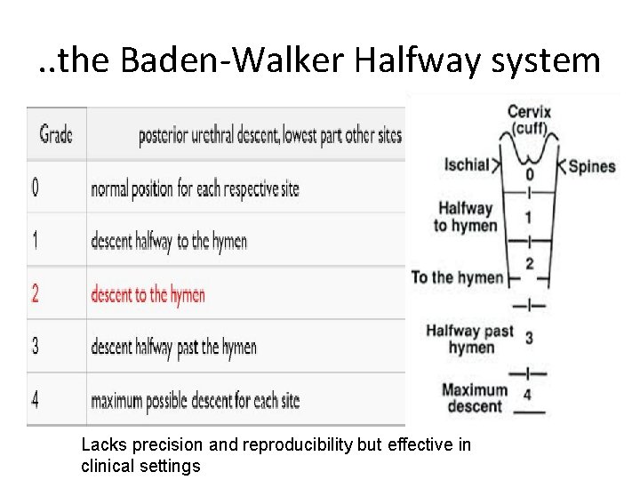 . . the Baden-Walker Halfway system Lacks precision and reproducibility but effective in clinical