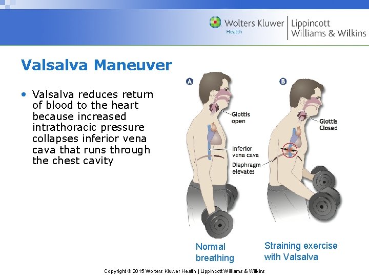Valsalva Maneuver • Valsalva reduces return of blood to the heart because increased intrathoracic