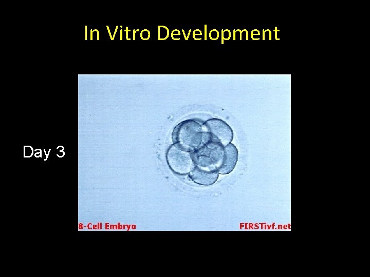 In Vitro Development Day 3 