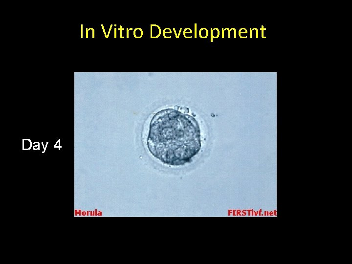 In Vitro Development Day 4 