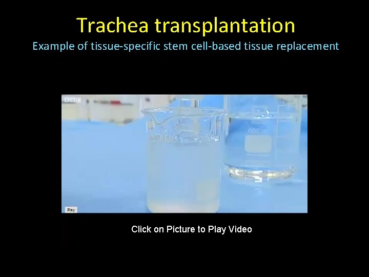 Trachea transplantation Example of tissue-specific stem cell-based tissue replacement Click on Picture to Play