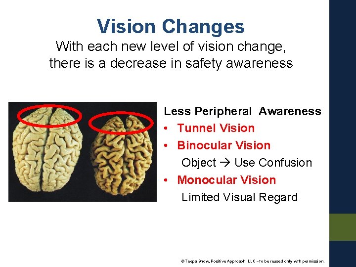 Vision Changes With each new level of vision change, there is a decrease in