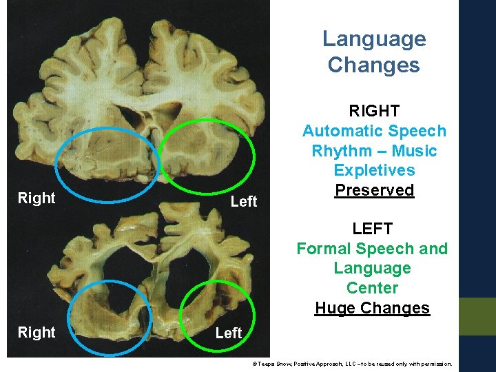 Language Changes Right Left RIGHT Automatic Speech Rhythm – Music Expletives Preserved LEFT Formal