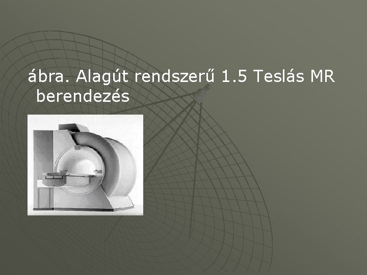  ábra. Alagút rendszerű 1. 5 Teslás MR berendezés 