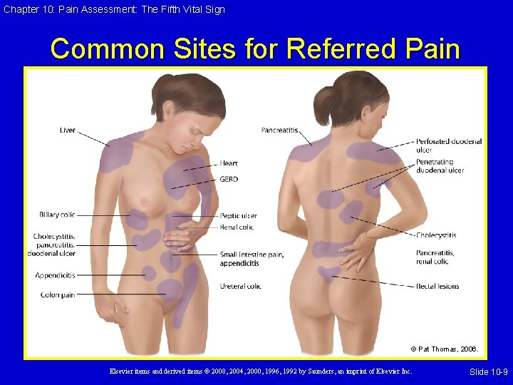 Chapter 10: Pain Assessment: The Fifth Vital Sign Common Sites for Referred Pain ©