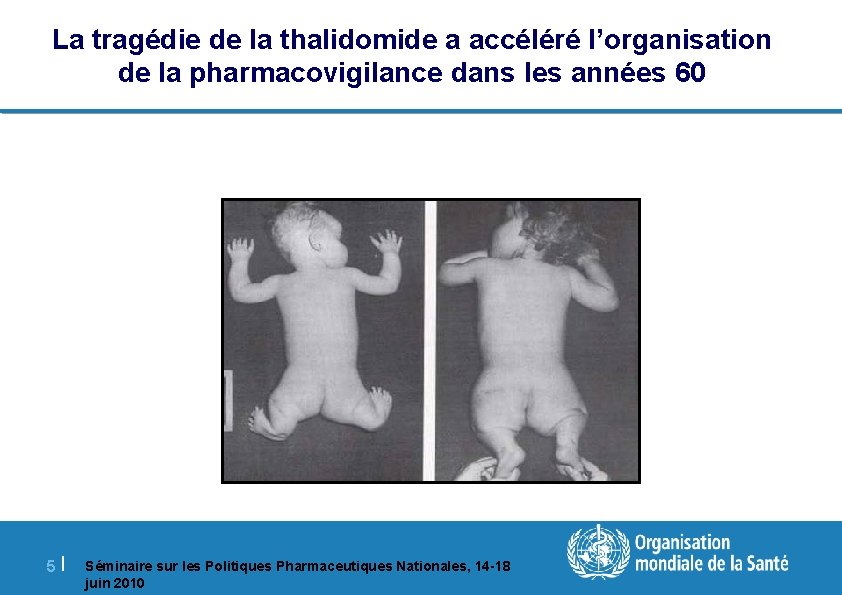 La tragédie de la thalidomide a accéléré l’organisation de la pharmacovigilance dans les années