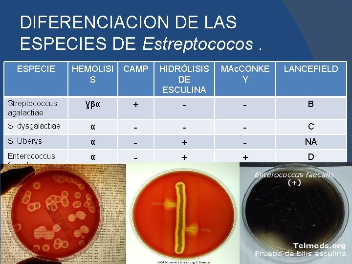 DIFERENCIACION DE LAS ESPECIES DE Estreptococos. ESPECIE HEMOLISI S CAMP HIDRÓLISIS DE ESCULINA MAc.
