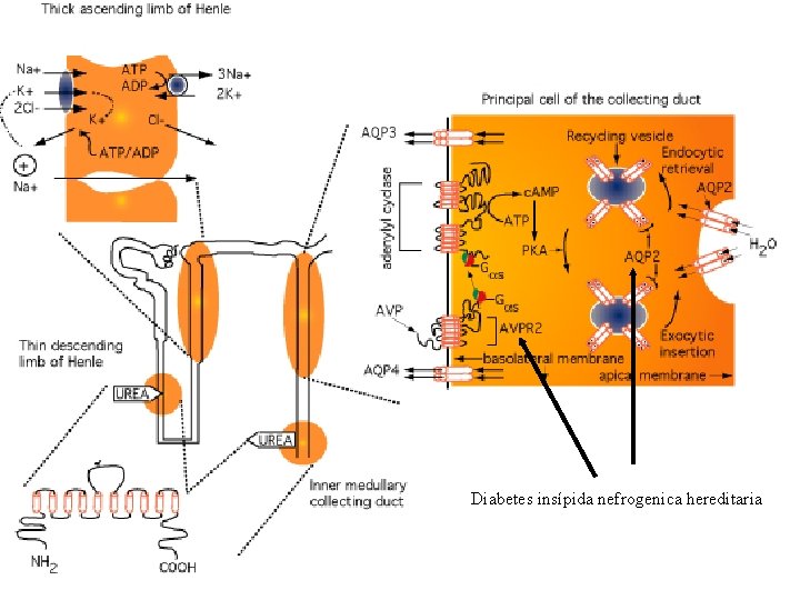 Diabetes insípida nefrogenica hereditaria 