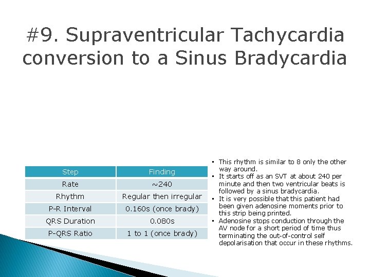 #9. Supraventricular Tachycardia conversion to a Sinus Bradycardia Step Finding Rate ~240 Rhythm Regular #9. Supraventricular Tachycardia conversion to a Sinus Bradycardia Step Finding Rate ~240 Rhythm Regular