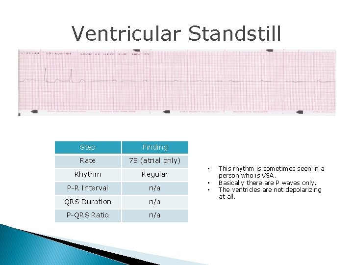 Ventricular Standstill Step Finding Rate 75 (atrial only) Rhythm Regular P-R Interval n/a QRS Ventricular Standstill Step Finding Rate 75 (atrial only) Rhythm Regular P-R Interval n/a QRS