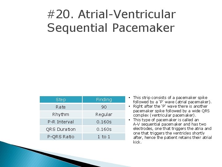 #20. Atrial-Ventricular Sequential Pacemaker Step Finding Rate 90 Rhythm Regular P-R Interval 0. 160 #20. Atrial-Ventricular Sequential Pacemaker Step Finding Rate 90 Rhythm Regular P-R Interval 0. 160