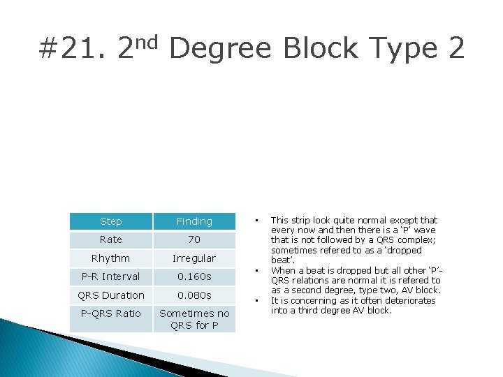 #21. 2 nd Degree Block Type 2 Step Finding Rate 70 Rhythm Irregular P-R #21. 2 nd Degree Block Type 2 Step Finding Rate 70 Rhythm Irregular P-R
