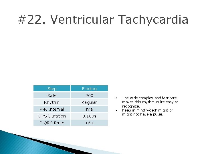 #22. Ventricular Tachycardia Step Finding Rate 200 Rhythm Regular P-R Interval n/a QRS Duration #22. Ventricular Tachycardia Step Finding Rate 200 Rhythm Regular P-R Interval n/a QRS Duration
