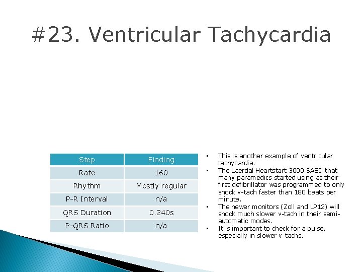 #23. Ventricular Tachycardia Step Finding • Rate 160 • Rhythm Mostly regular P-R Interval #23. Ventricular Tachycardia Step Finding • Rate 160 • Rhythm Mostly regular P-R Interval