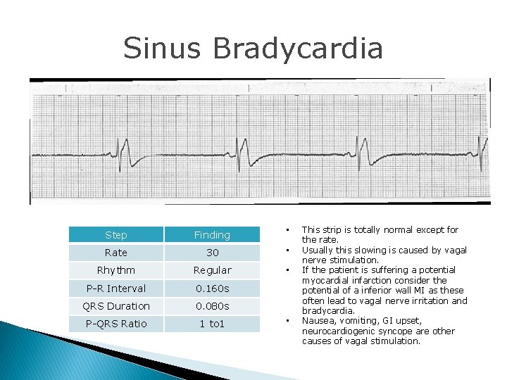 Ecg Lead Ll Interpretation Answers 1 2 Nd